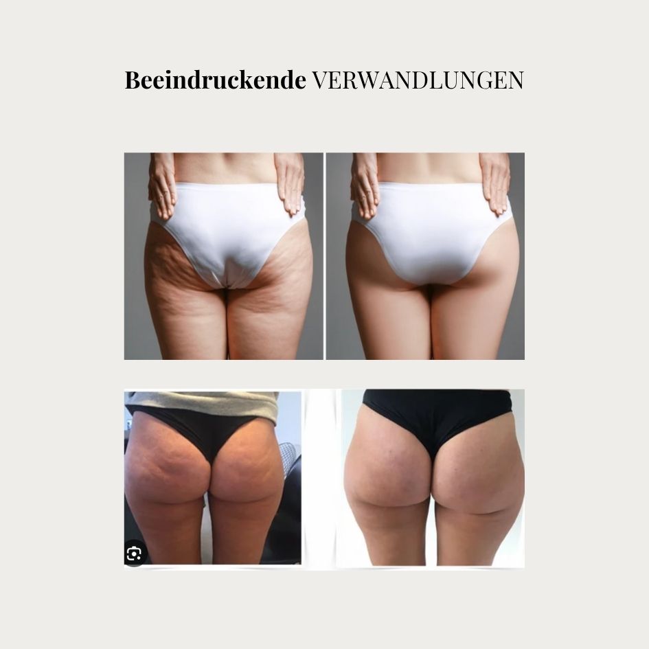 Linéa™– 3D Anti-Cellulite-Leggings